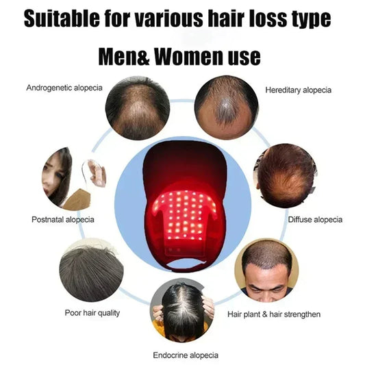 Red Light Therapy Hair Growth Cap | LLLT Device for Hair Loss Treatment | USB Rechargeable Anti-Hair Thinning